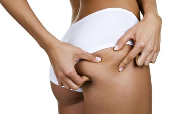 Toutes nos astuces pour lutter contre la cellulite