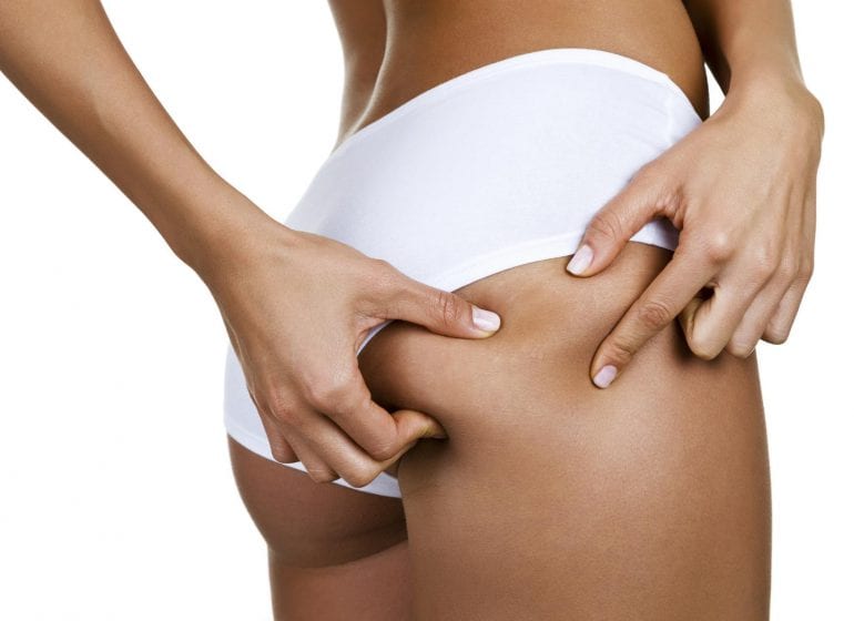 Toutes nos astuces pour lutter contre la cellulite