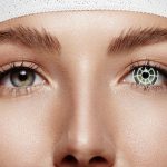 chirurgie réfractive